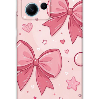 5803-xiaomi-redmi-note-12-4g-kurdele-desenli-kilif