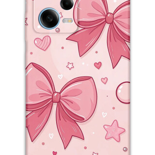 5803-xiaomi-redmi-note-12-pro-5g-redmi-note-12-5g-kurdele-desenli-kilif