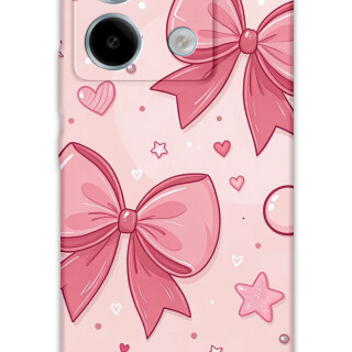 5803-xiaomi-redmi-note-13-pro-5g-redmi-note-13-pro-4g-poco-m6-pro-kurdele-desenli-kilif