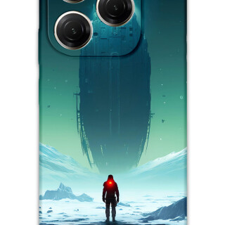 5864-tecno-spark-20-pro-5g-uzay-desenli-kilif