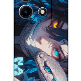 5748-infinix-note-30-vip-obanai-iguro-desenli-kilif