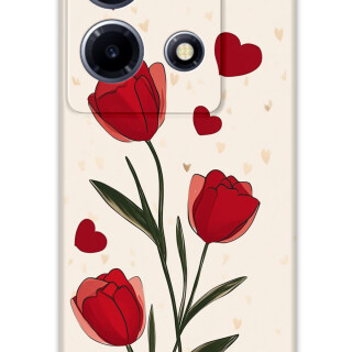 5789-infinix-note-30-vip-cicek-desenli-kilif