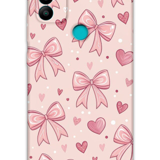 5802-gm-21-plus-kurdele-desenli-kilif