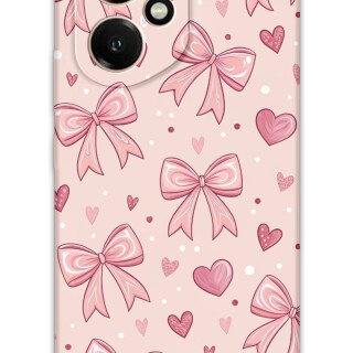 5802-huawei-honor-400-kurdele-desenli-kilif