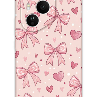 5802-huawei-honor-400-pro-kurdele-desenli-kilif