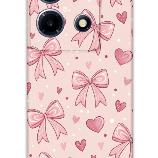 5802-infinix-note-30-vip-kurdele-desenli-kilif