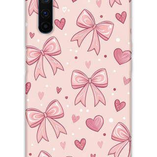 5802-realme-6-pro-kurdele-desenli-kilif