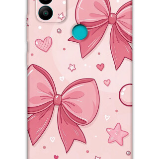 5803-gm-21-plus-kurdele-desenli-kilif