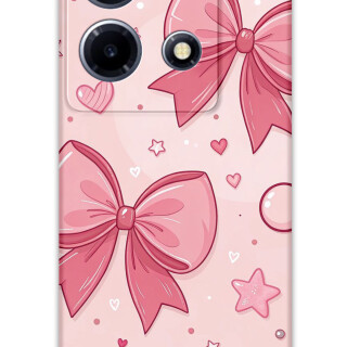 5803-infinix-note-30-vip-kurdele-desenli-kilif