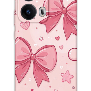 5803-oppo-reno-13-pro-5g-kurdele-desenli-kilif