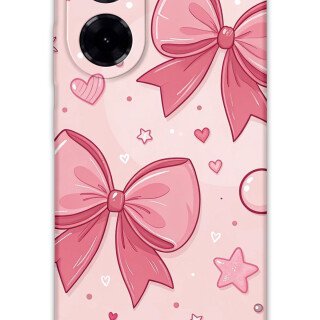 5803-xiaomi-redmi-a5-4g-kurdele-desenli-kilif