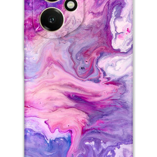 5813-huawei-honor-400-mermer-desenli-kilif