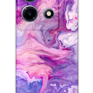 5813-infinix-note-30-vip-mermer-desenli-kilif