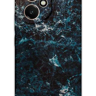 5819-huawei-honor-400-mermer-desenli-kilif