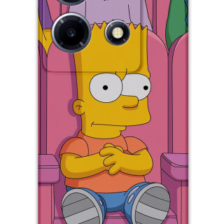 5820-infinix-note-30-vip-simpson-desenli-kilif