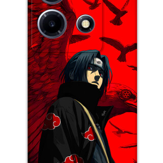 5872-infinix-note-30-vip-itachi-uchiha-desenli-kilif