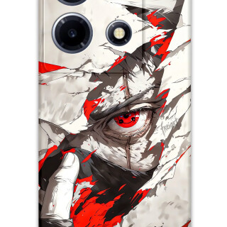 5876-infinix-note-30-vip-itachi-uchiha-desenli-kilif