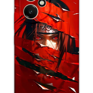 5885-huawei-honor-400-itachi-uchiha-desenli-kilif