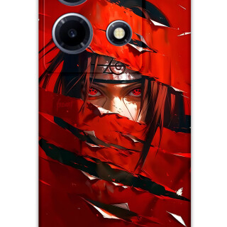 5885-infinix-note-30-vip-itachi-uchiha-desenli-kilif