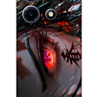 5907-infinix-note-30-vip-anime-desenli-kilif