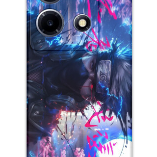 5910-infinix-note-30-vip-anime-desenli-kilif