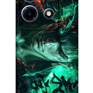 5921-infinix-note-30-vip-anime-desenli-kilif