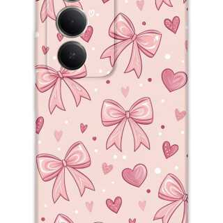 5802-xiaomi-redmi-15-5g-kurdele-desenli-kilif