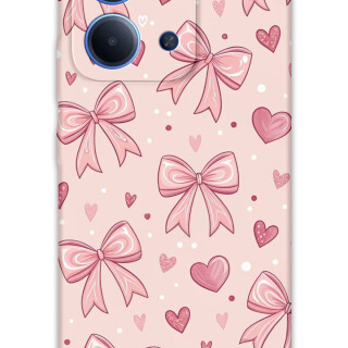 5802-xiaomi-redmi-15c-kurdele-desenli-kilif