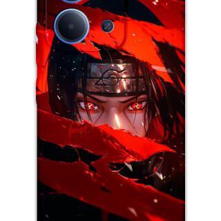 5874-xiaomi-redmi-15c-itachi-uchiha-desenli-kilif