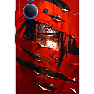 5885-xiaomi-redmi-15c-itachi-uchiha-desenli-kilif