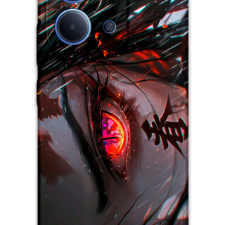 5907-xiaomi-redmi-15c-anime-desenli-kilif